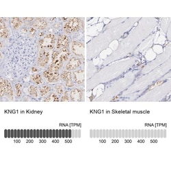 Kininogen Antibody, Novus Biologicals 25 &mu;L; Unlabeled:Antibodies, Polyclonal